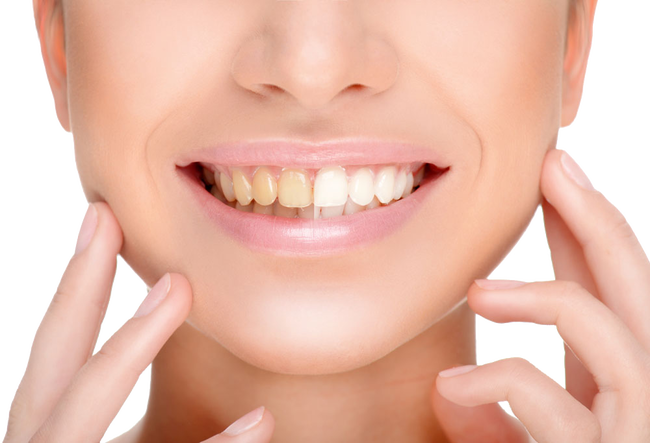 USA Market Approved 100% Organic Activated Teeth Whitening Coconut Charcoal Powder