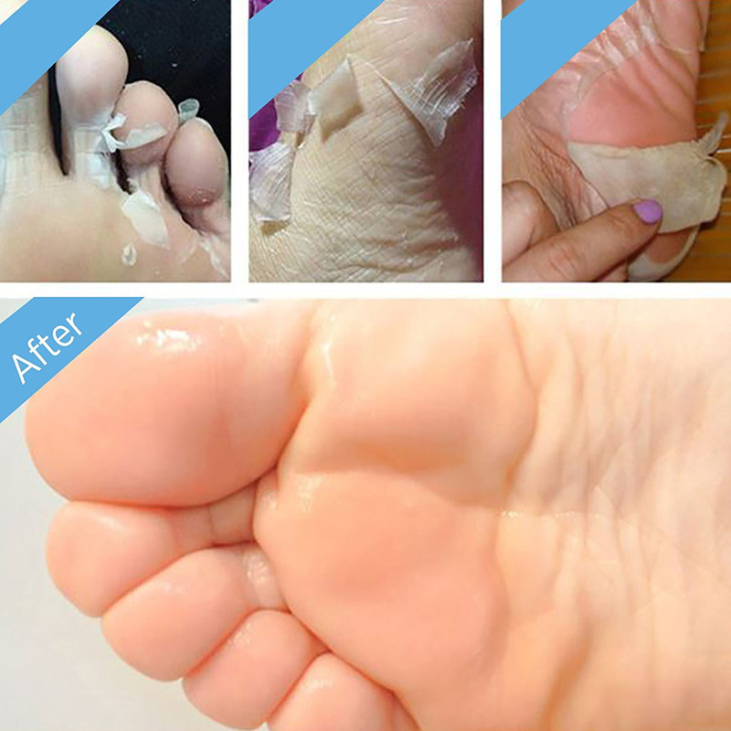 custom logo natural Foot Exfoliation Peeling Mask For Soft, Smooth Feet- callus removal & Dead Skin Cells(2 Pairs )