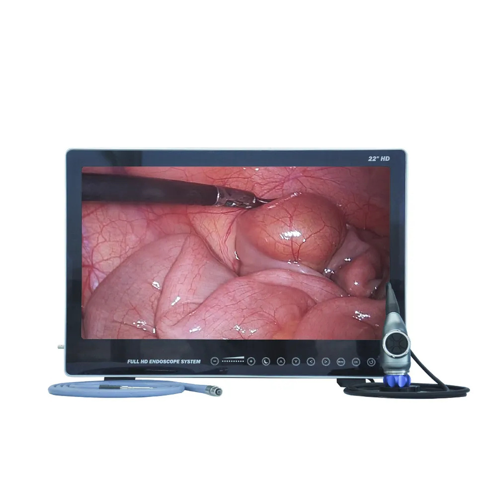 4 In 1 Integrated Endoscope ENT Arthroscopic Surgical Laparoscopic Camera with 22 Inch Medical Grade Monitor