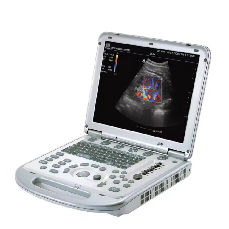 Mindary Ultrasound M7 Portable Full Digital Color Doppler Ultrasound Machine Clinical Application Ultrasound Scanner Price