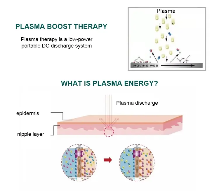 PlasmaJet Plasma lift cold Ozone plasma pen eyelid lifting /ance removal jet lifting pen / Skin rejuvenation