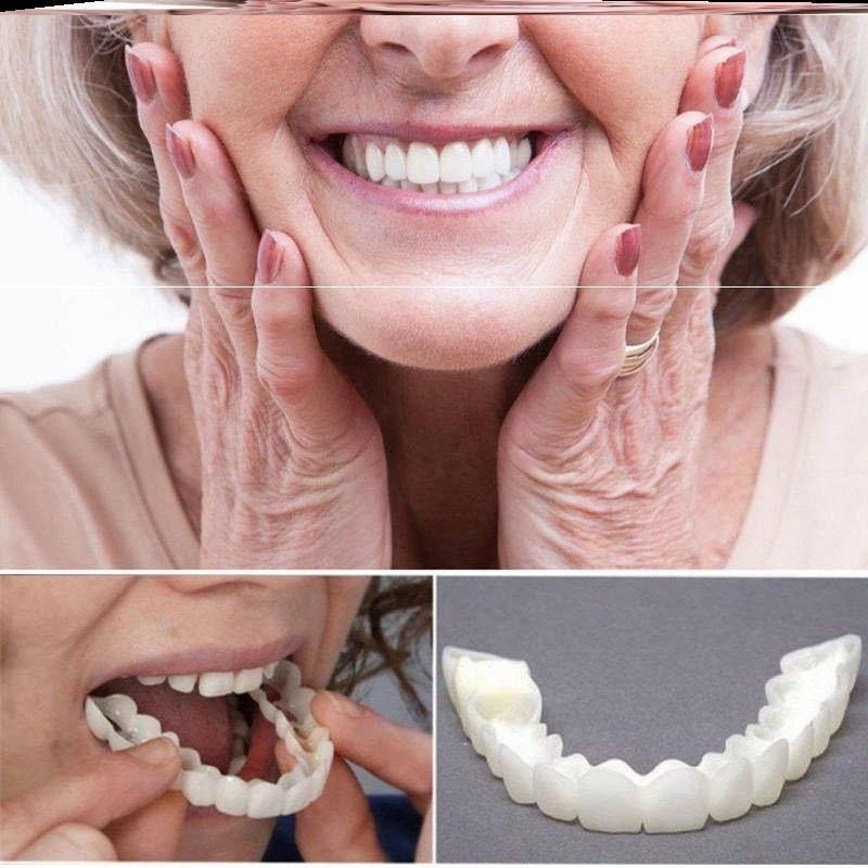 Snap smile customized Perfect Smile teeth Upper lower False teeth cover Denture socket on sale