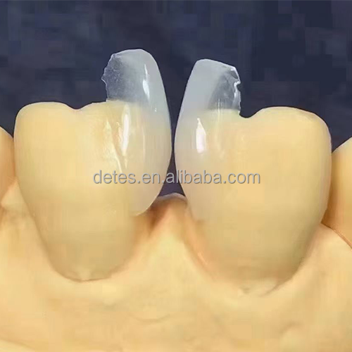 New style veneers dental teeth smile porcelain teeth  zirconia ceramic false teeth acrylic denture