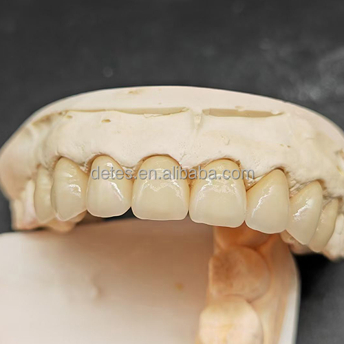 Professional Dental Lab in China New veneers dental teeth smile porcelain teeth  zirconia ceramic false teeth acrylic denture