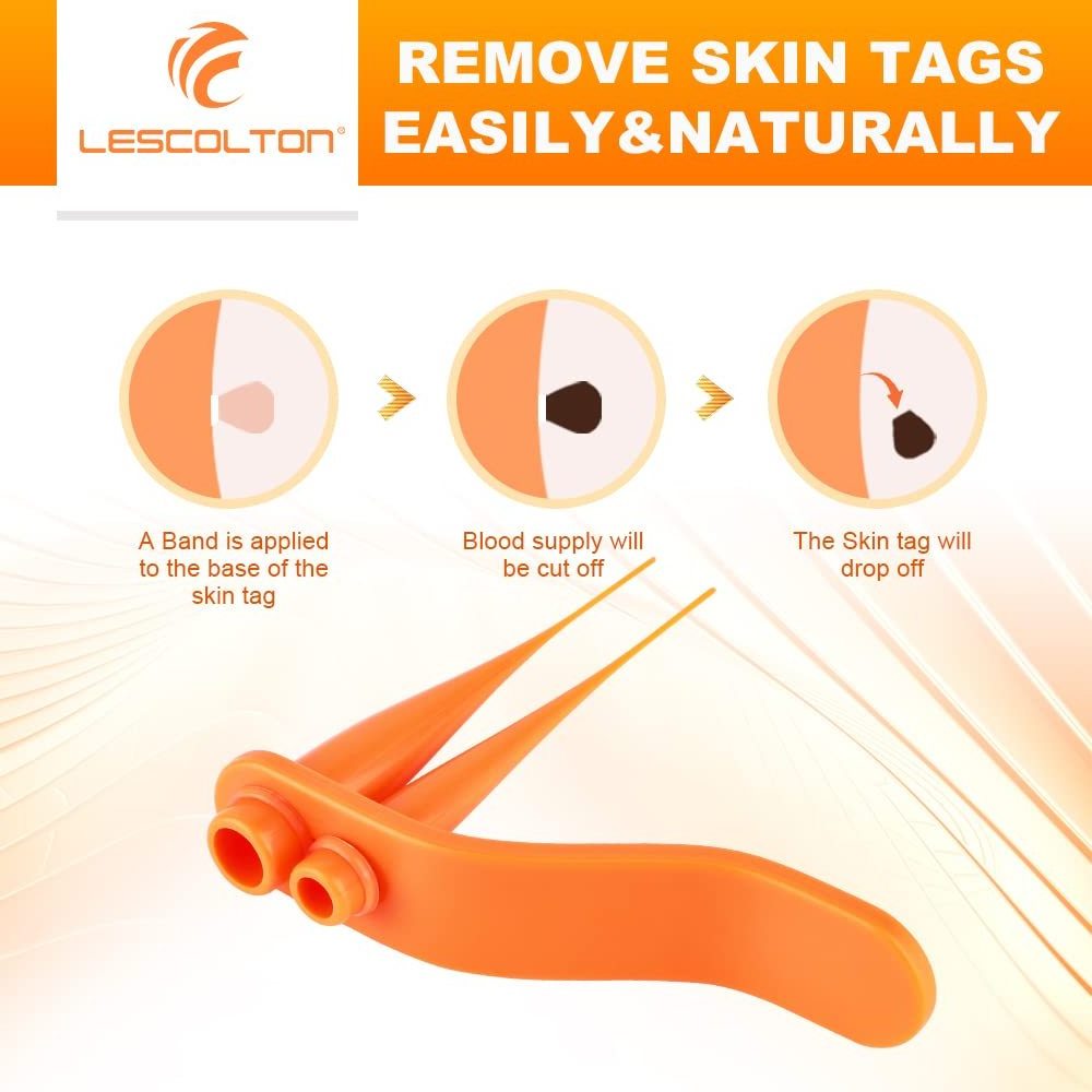 2In1 Painless Auto Skin Tag Mole Wart Removal Kit Face Skin Care Body Wart and Dot Treatment Remover Plantar Warts Corn Removal