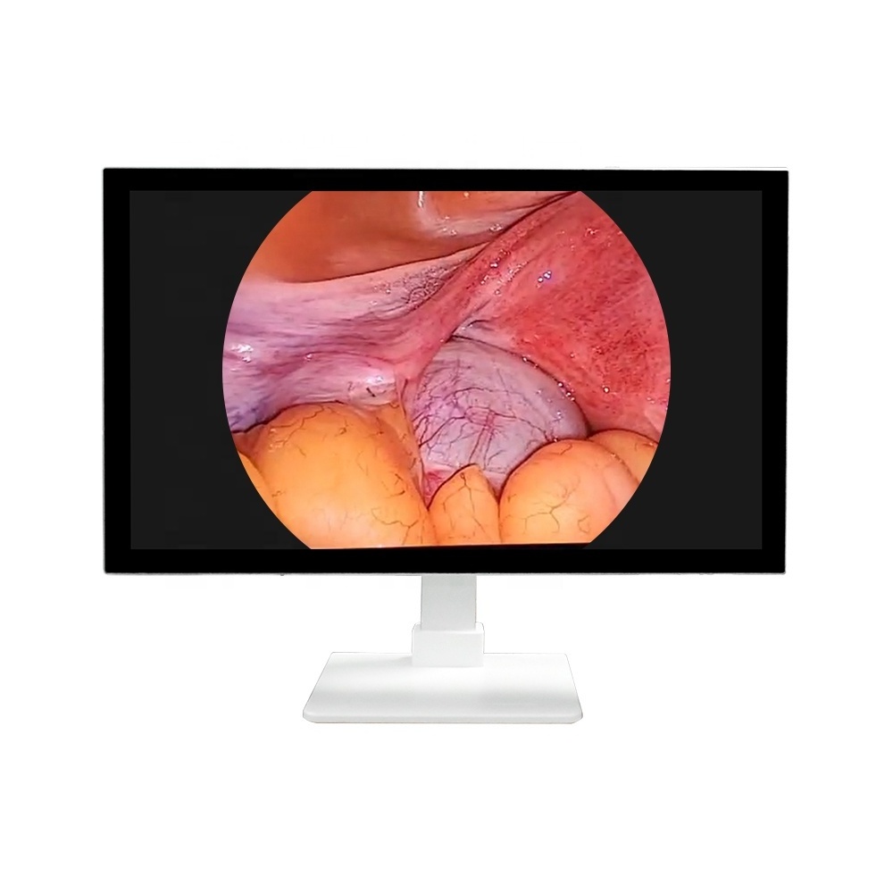 2023 HOT SALE New product Medical Endoscopic 4K LCD Monitor 27 32 inch Medical Grade Monitor For Laparoscope Surgery