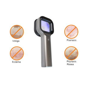 NEW Portable Woods Lamp Medical Grade Microscope Dermatoscope  Rechargeable Skin Hair Analyzer