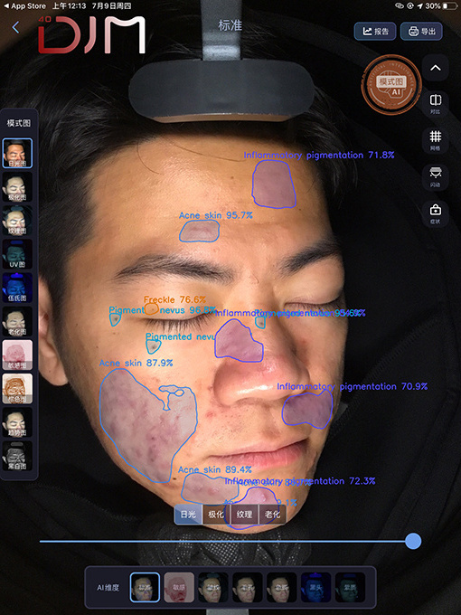 2023 AI Technology 3D Facial Scanner Skin Analyzer Portable Skin Analysis Machine From German