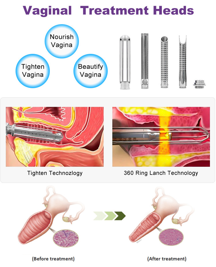 Super Power Professional Fractional Co2 Laser Fraccionado Beauty Machine For Wrinkles Removal