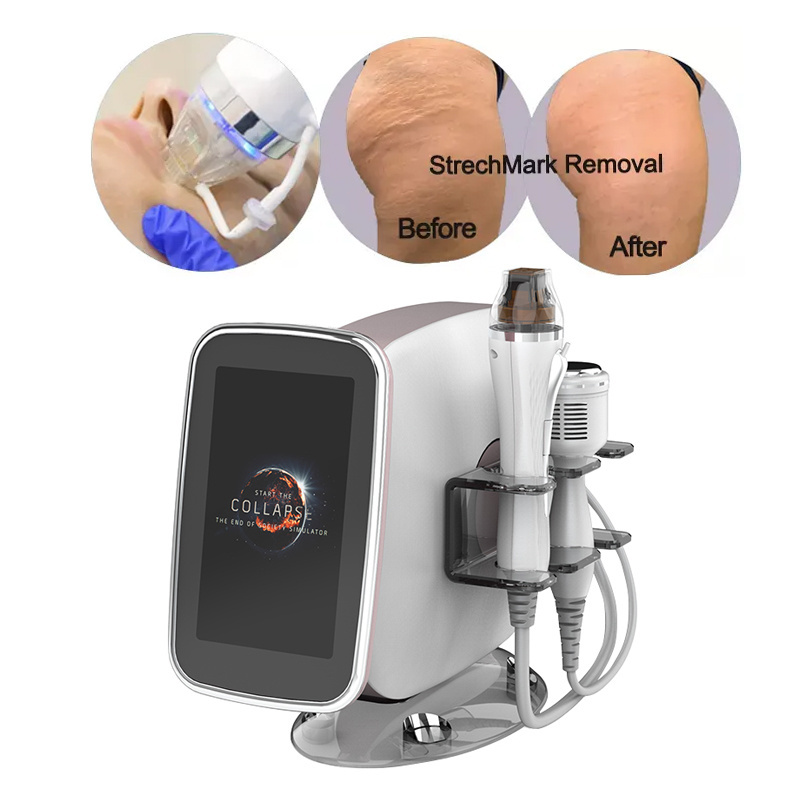 Portable Rf Microneedle Machine Stretch Scars Marks Removal Fractional Micro Needling Beauty Device