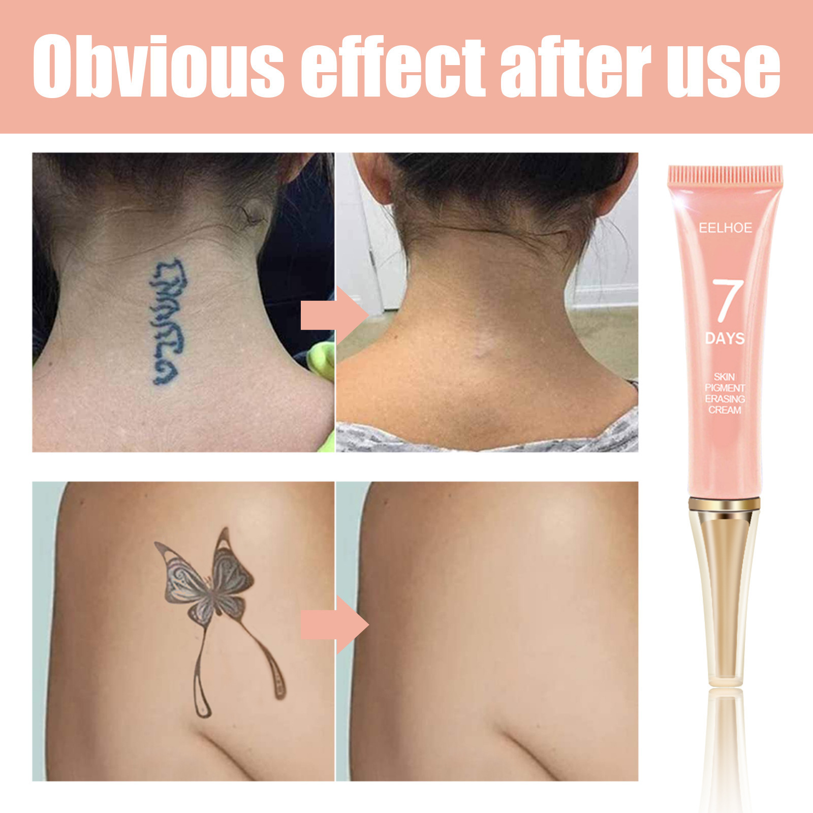 High Quality Effectively Fading Cleansing Tattoo Removal Cream with Quickly Tattoo removal Gentle Non-irritating