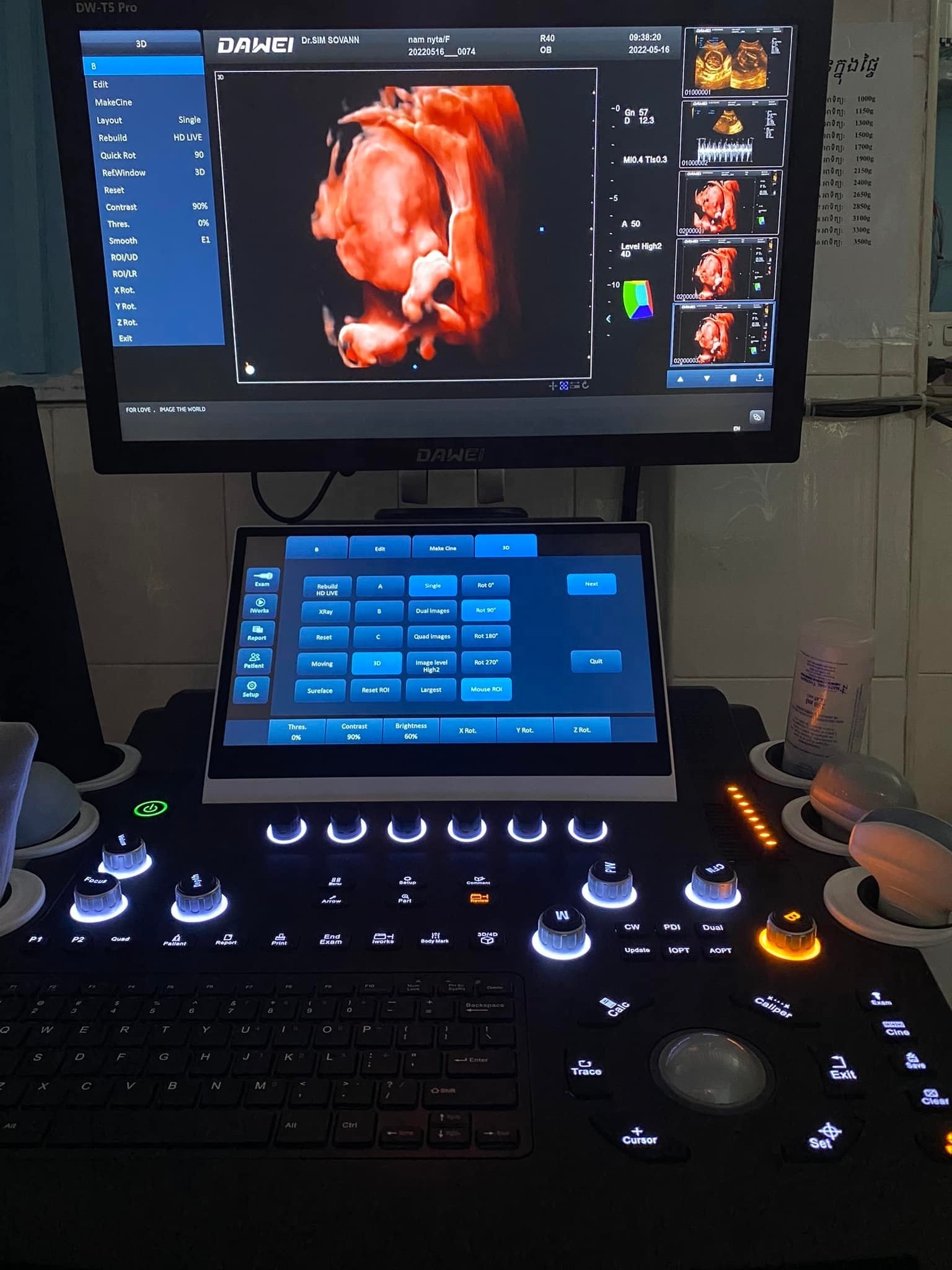 diagnostic ultrasound scanner  3D 4D color doppler ultrasound machine with reasonable price like mindray ultrasound