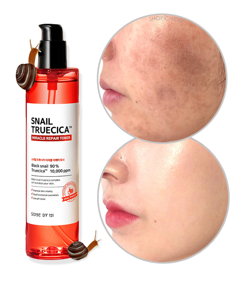 Korea  Skin Care Anti-aging Cosmetics Products SOME BY MI SNAIL TRUECICA MIRACLE REPAIR TONER 135ML