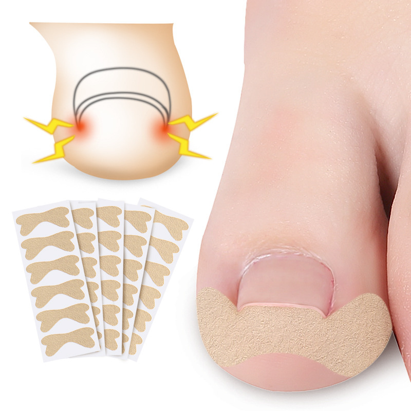 Pedicure Ingrown Nail Tools Toenail Stickers for Nails Corrector Paronychia Treatment Fixer Recover Bunion Pedicura Feet Care