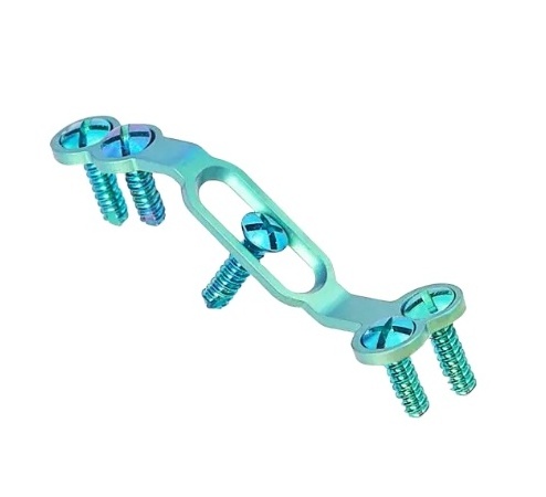 Laminoplasty Plate Fixation System Titanium Posterior Cervical Plate for Spine Fixation