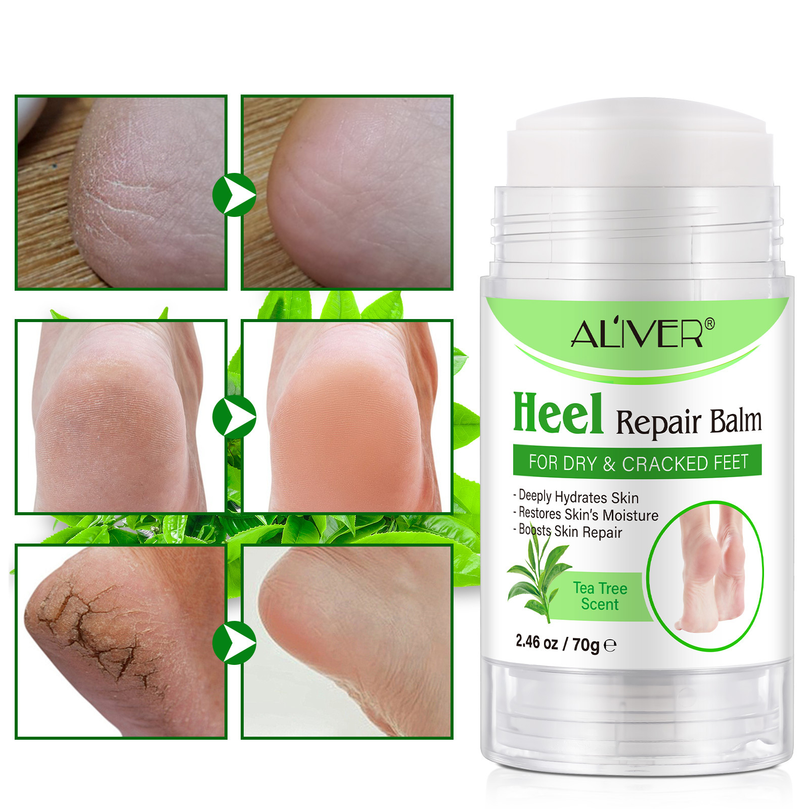 ALIVER Foot Care Anti Dry Cracked Heels Feet Repair Cream Intensive Moisturizing Whitening Heel Repair Balm Foot Balm Heel Stick