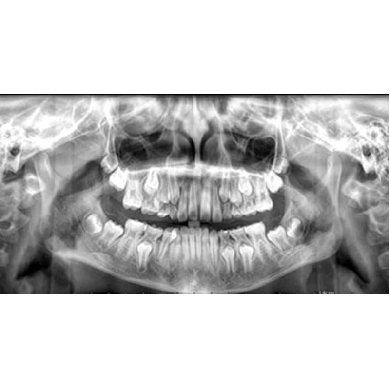 Hot Sell 2D 3D CBCT Panoramic X Ray Imaging Digital Cephalometric Panoramic Dental X-ray Machine