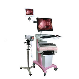 Colposcope for women vagina diagnosis,beautiful vagina colposcope camera DVC5004