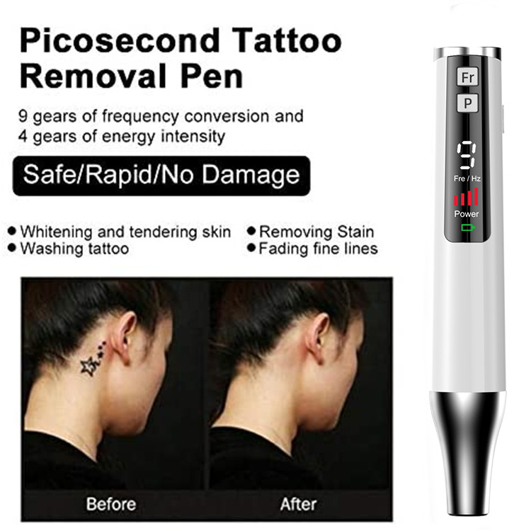 PAKISS Dark Spot Tattoo Removal 9 gears Red light Tattoo Pigment Scar plug-in Removal Picosecond laser pen