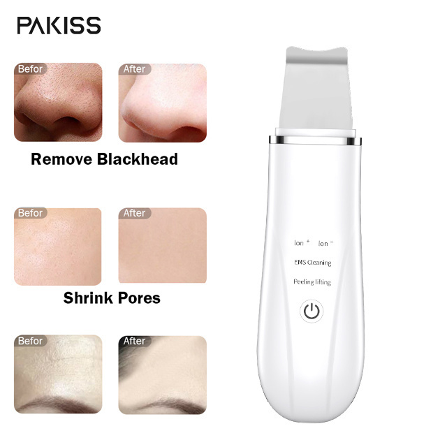 Hot sale Ultrasonic Beauty Equipment Skin Scrubber Deep Cleansing Sonic Peeler blackhead remover skin scrubber