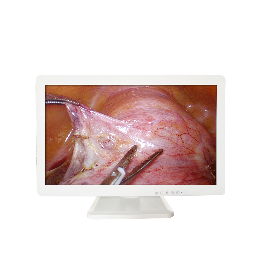 Medical Monitor 32 inch Laparoscopic 4K 3D medical LCD monitor for laparoscope