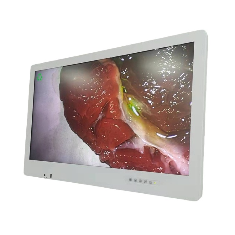 Medical Monitor 32 inch Laparoscopic 4K 3D medical LCD monitor for laparoscope