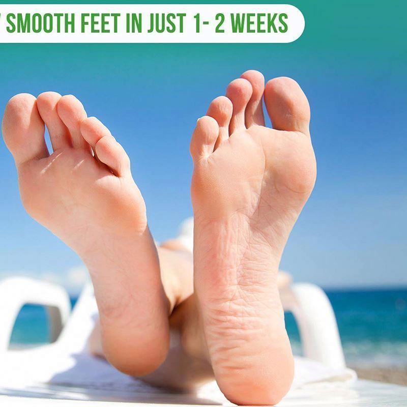 Make Your Feet Baby Care Men Women Exfoliating foot peel mask extract dry treatment for soft skin Socks