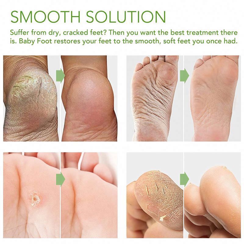 OEM Callus Removal Beauty Skin Peel Spa Socks Exfoliating peeling Foot Mask 2023 Trending Product Whitening Softening Feet