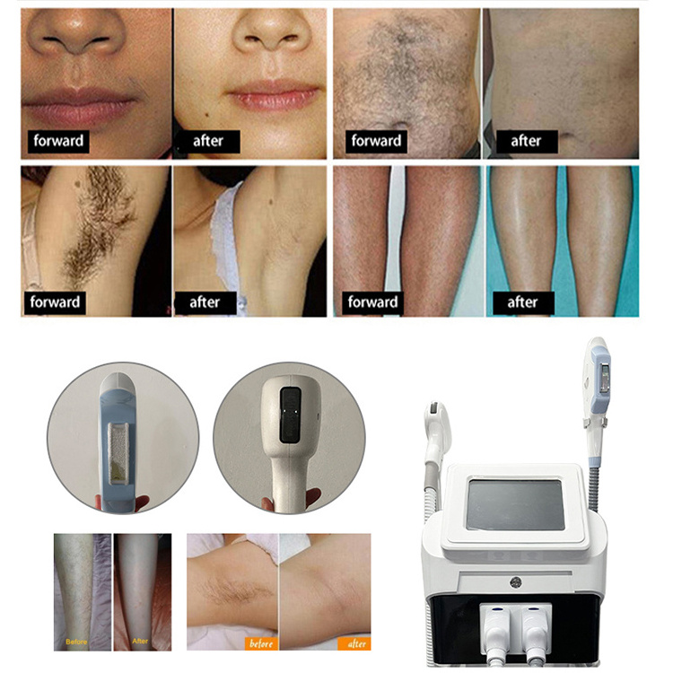 Ipl Hair Removal Underarm Whitening Machine Ipl Opt Sapphire Skin Care Rejuvenation Machine Diode Laser Prix 10 Bar Diode