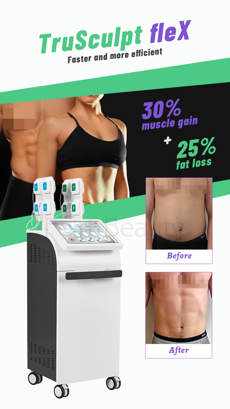 Hottest Trusculpt Flex RF Trushape Tru Sculpt Monopolar RF Radio Frequency Body Weight Loss Machine