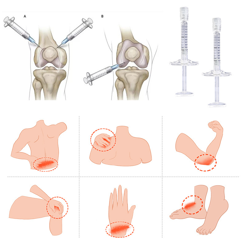 2023 Newest no-cross linked-hyaluronic acid knee injection stylage filler