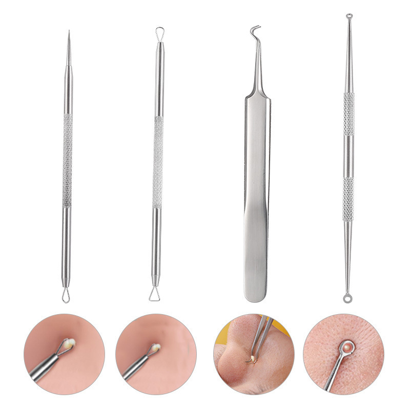 FOCSTAR 4PCS Stainless Steel Blackhead Removal Extractor Tool Set Acne Remover Tool Kit (BTE010)