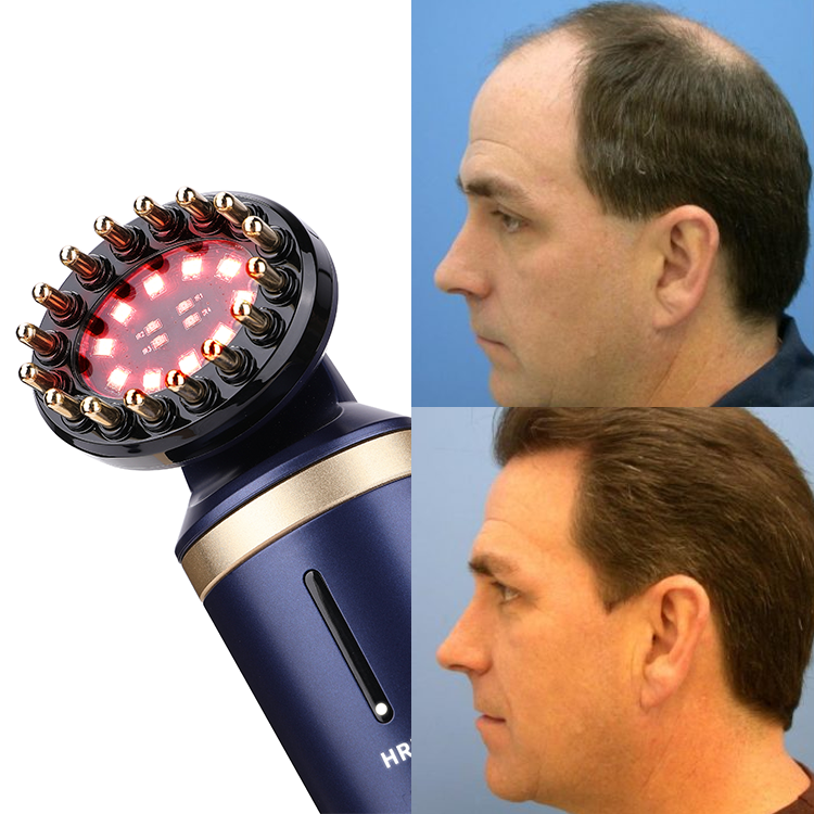 New Diode Led Laser Oxygen Therapy Hair Growth Comb Laser Machine Easy To Operation