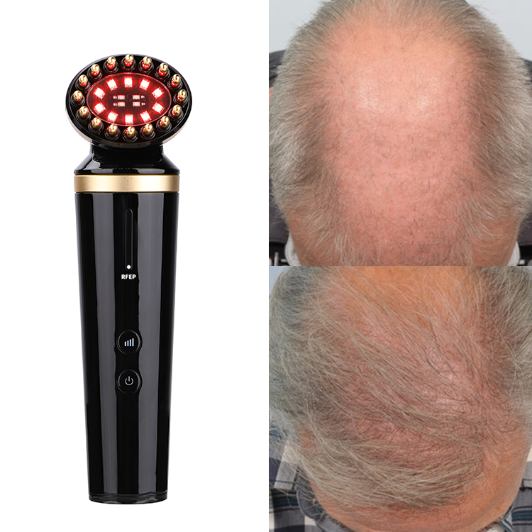 Chinese Led Phototherapy Infrared Laser Comb Head Electric Hairloss Hair Growth Machine