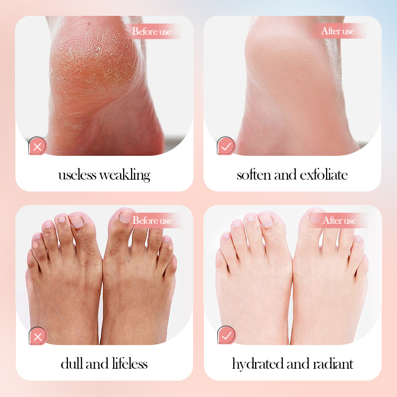 SADOER Organic Plant Extract Collagen Spa Socks Foot Peel Mask Whitening Exfoliating Foot Mask OEM ODM Korea Private Label Rose