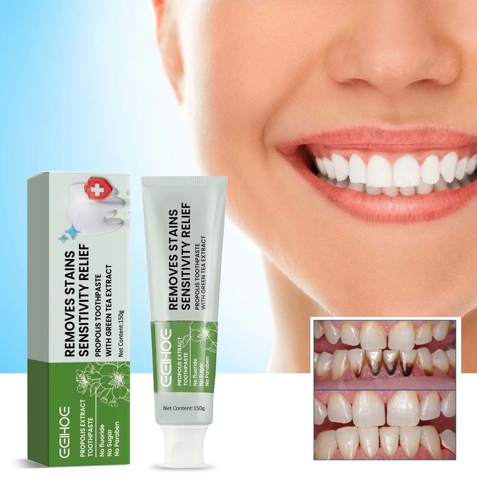 EELHOE Private Label Oem Natural Teeth Whitening Products 150g Flouride Free Stain Removal Propolis Toothpaste