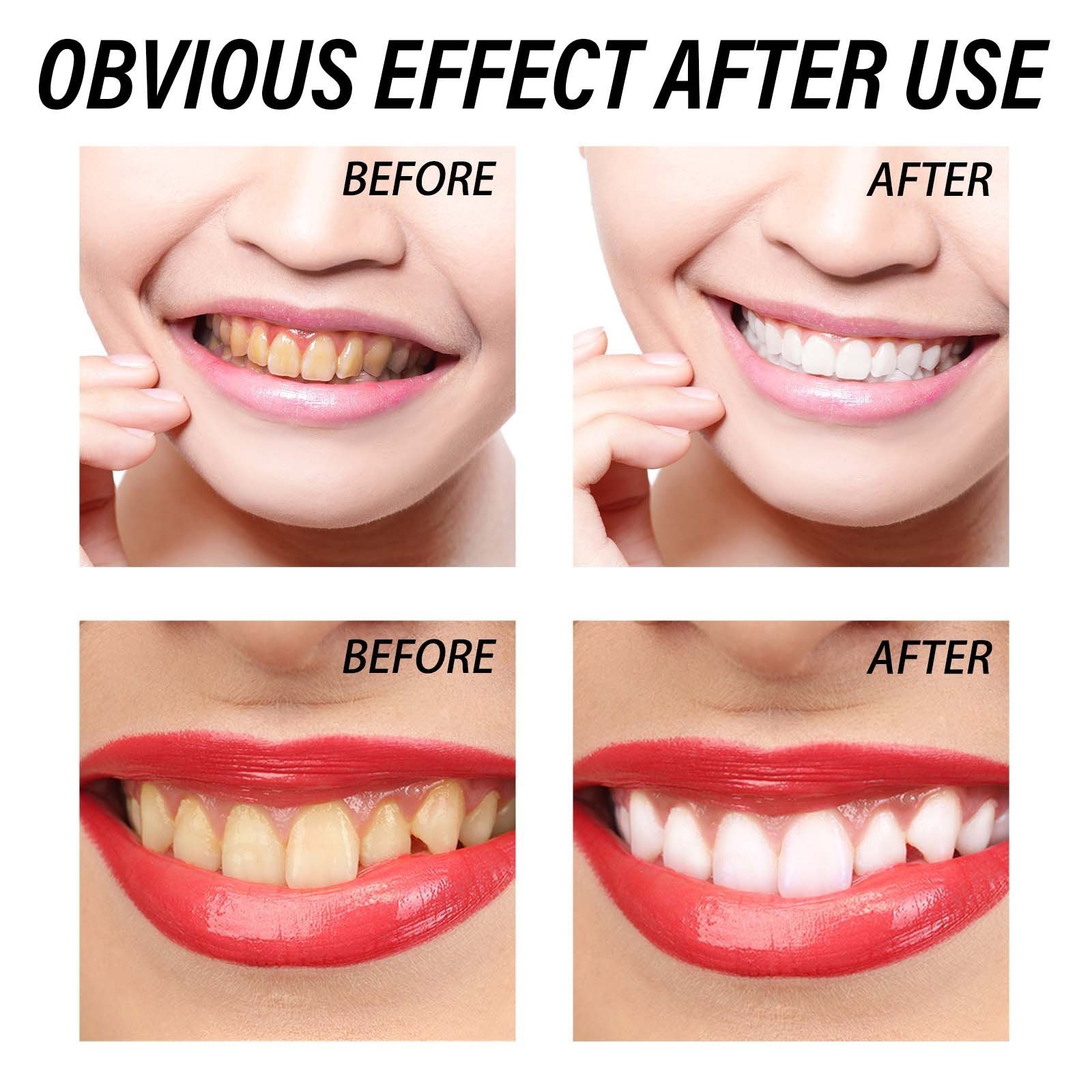 EELHOE Private Label Oem Natural Teeth Whitening Products 150g Flouride Free Stain Removal Propolis Toothpaste