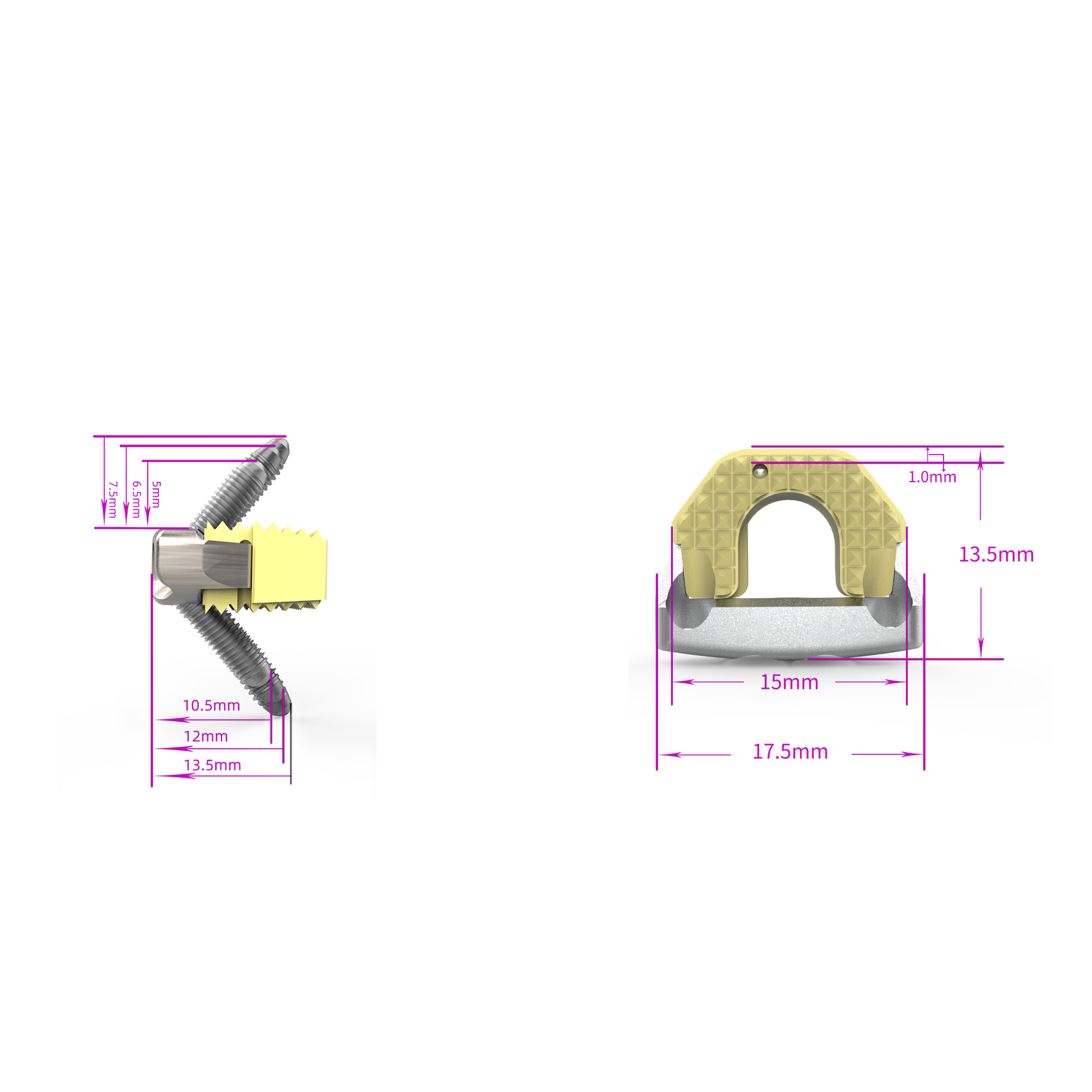 Medical Disposable Implants for Cervical Spine Fixation Zero Profile Interbody Fusion Cage with Four Screws Orthopedic Surgery