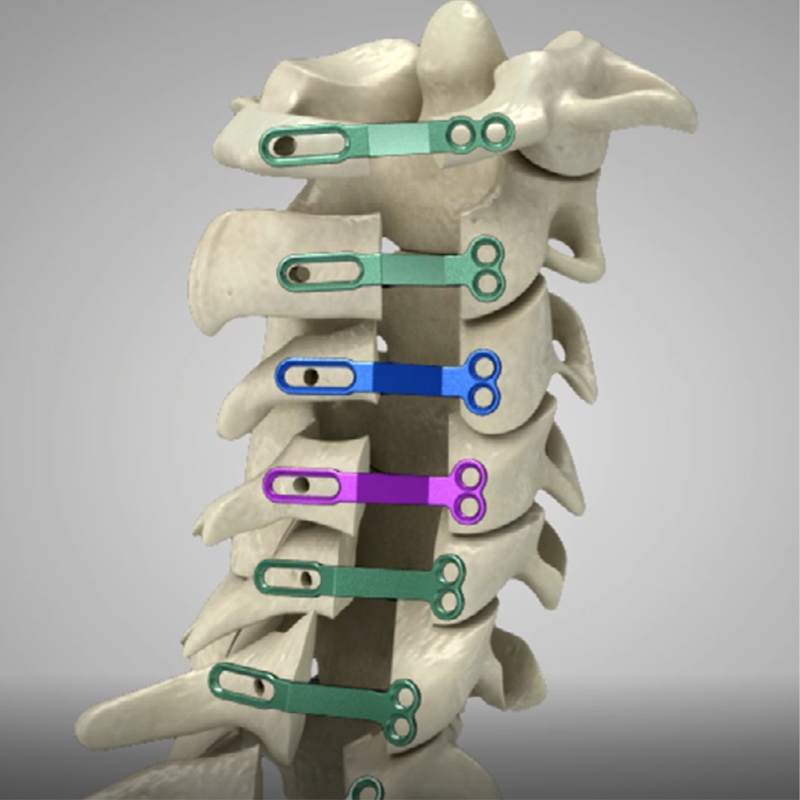 Orthopedic Implant Cervical Spine Fixation System Open Door Lateral Hole Plate