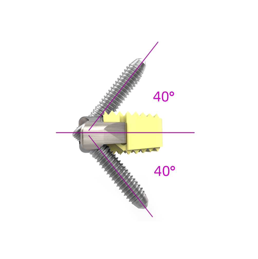 Medical Disposable Implants for Cervical Spine Fixation Zero Profile Interbody Fusion Cage with Four Screws Orthopedic Surgery