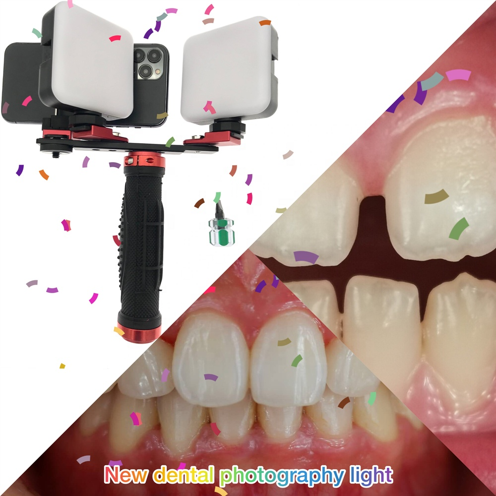 Mobile Phone Dental Photography Light, LED Filling Light for dentists Oral Intra-oral photography equipment for dentistry