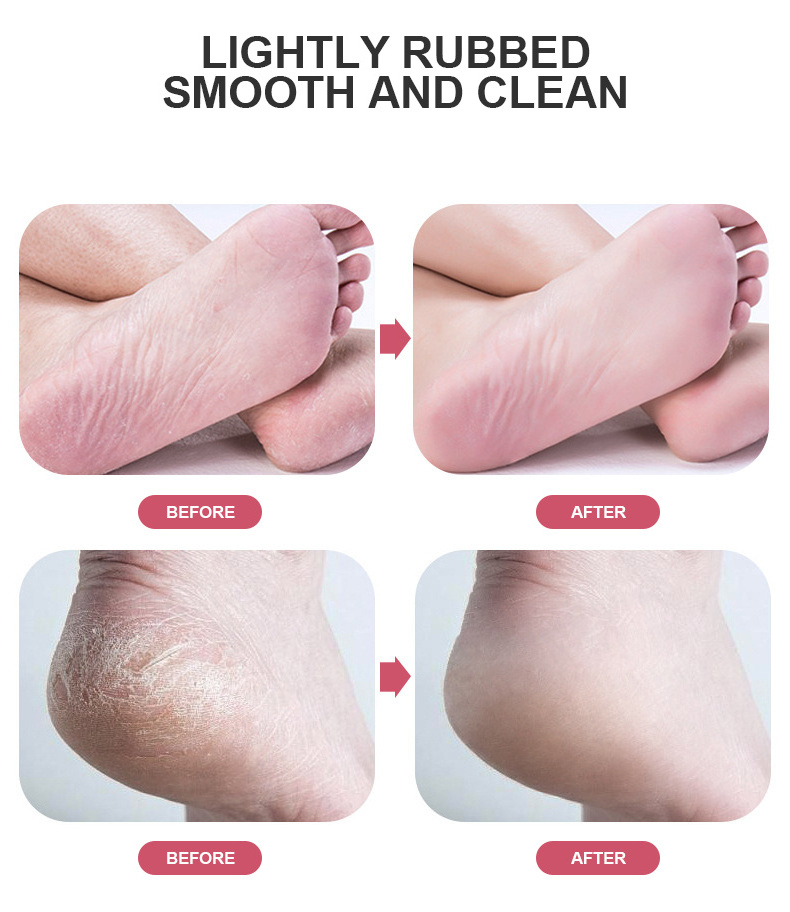 Electric Foot File Remover & Electronic Foot Grinder Professional Remove Cracked Heels and Dead Skin Remover