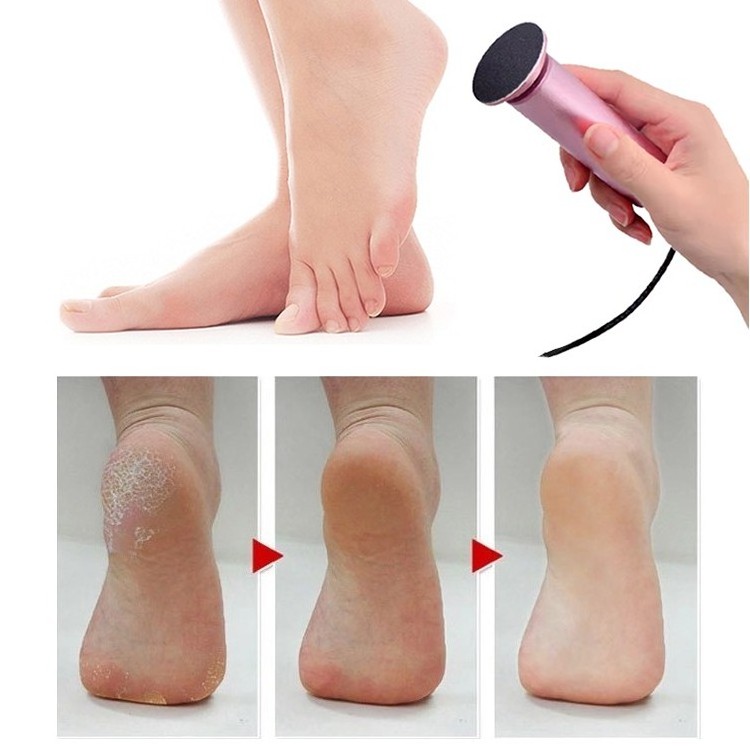 Creative pedicure products foot file callus remover kit with 80 100 120 mesh replaceable sandpaper