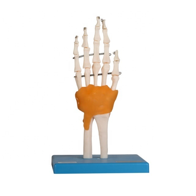 GD/A11209/5  General Doctor Human Anatomical Hand Joint Model