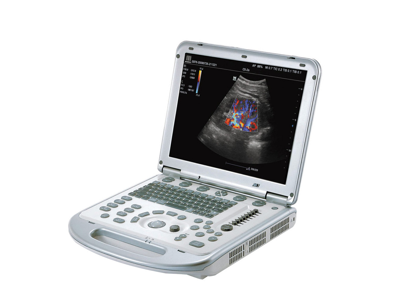 Hospital High Quality Color Doppler Imaging Mindray M7 Diagnostic Ultrasound Machine