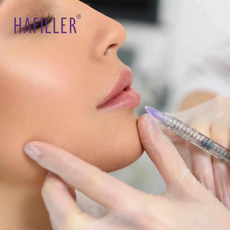 Body filler injections Hyaluronate Gel injected gel injection for nose lip cheek chin neck wrinkles folds