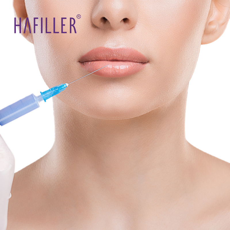 Body filler injections Hyaluronate Gel injected gel injection for nose lip cheek chin neck wrinkles folds