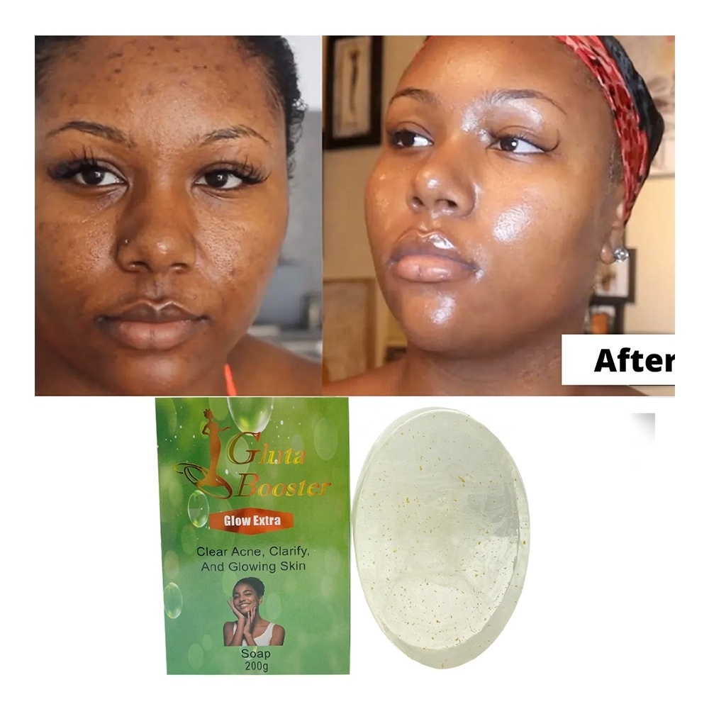 organic cleansing rejuvenating growth new skin dark spot removing savon scrub anti pimple acne treatment soap for african skin