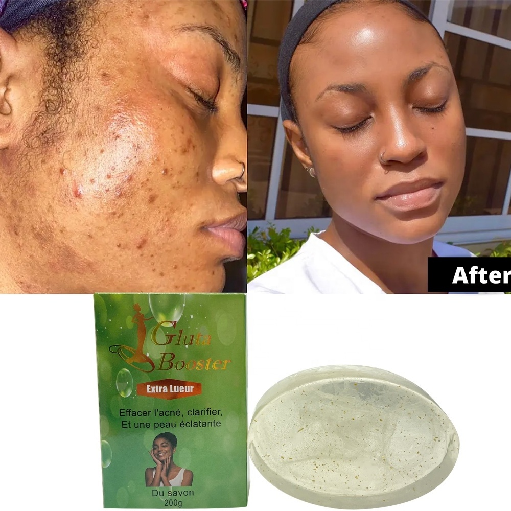 organic cleansing rejuvenating growth new skin dark spot removing savon scrub anti pimple acne treatment soap for african skin