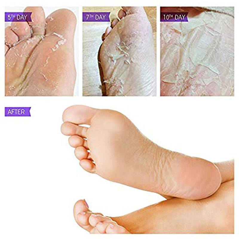 High Quality Exfoliating Spa Skin Care Foot Film Skin Whitening Foot Scrub